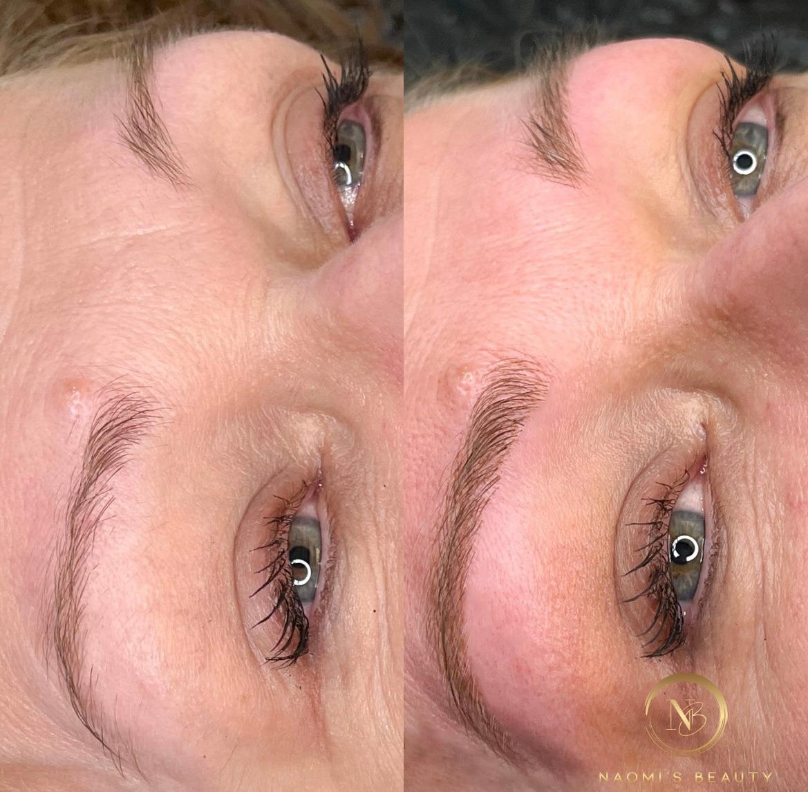MICROBLADING